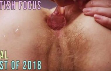 Festish Focus: Best Anal Of